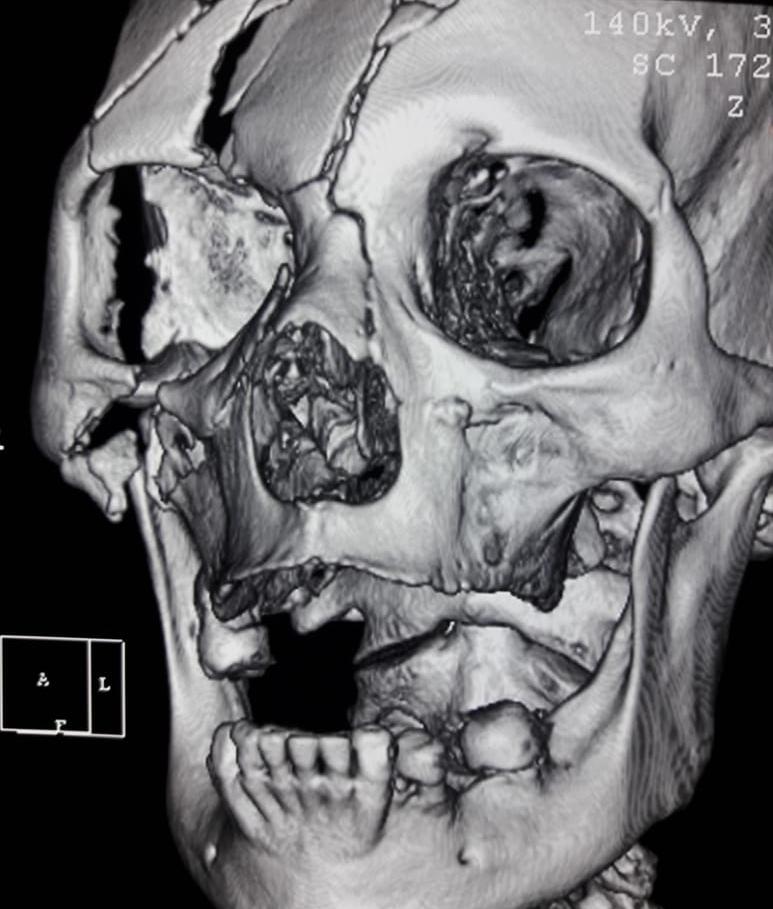 Dr. Rodo Villarroel Guzmán - imagen 3